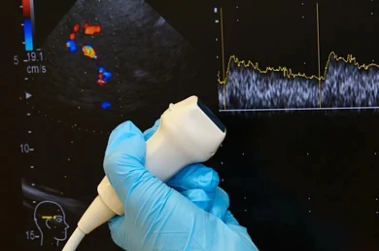 Doppler Scan